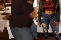 Bariatric Surgery - Before & After Weight Loss - Sleeve Gastrectomy (Gastric Sleeve) 