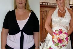 Lap-Band-Before-And-After-Stacy-2