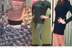 Lap-Band-Before-and-After-Aleksandra-Tukan-LBLA-branded