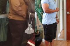 Before & After Gastric Sleeve Surgery by Dr Davtyan