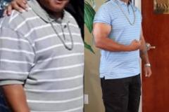 LapBandLA.com