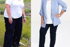 Bariatric Surgery - Before & After Weight Loss Photo - Lap-Band® Patient
