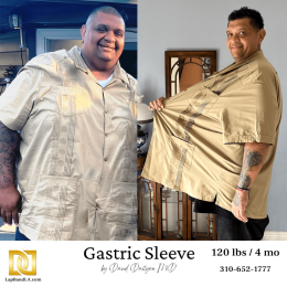 Oscar Gonzalez Before & After Sleeve v2 LBLA branded after surgery