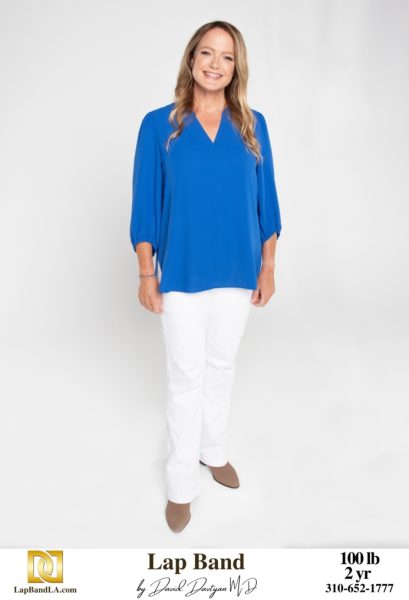 Bariatric Surgery - Before & After Weight Loss Surgery Photo - Gastric Band Sleeve Bypass Balloon