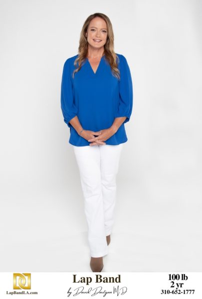 Bariatric Surgery - Before & After Weight Loss Surgery Photo - Gastric Band Sleeve Bypass Balloon