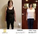 Bariatric Surgery - Before & After Weight Loss Surgery Photo - Gastric Band Sleeve Bypass Balloon