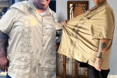 Oscar Gonzalez Before & After Sleeve v2 LBLA branded after surgery
