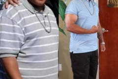 Bariatric Surgery - Before & After Weight Loss Surgery Photo - Gastric Band Sleeve Bypass Balloon