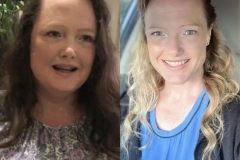 Bariatric Surgery - Before & After Weight Loss Surgery Photo - Gastric Band Sleeve Bypass Balloon