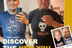 Bariatric Surgery - Before & After Weight Loss Surgery Photo - Gastric Band Sleeve Bypass Balloon