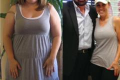 Bariatric Surgery - Before & After Weight Loss Surgery Photo - Gastric Band Sleeve Bypass Balloon
