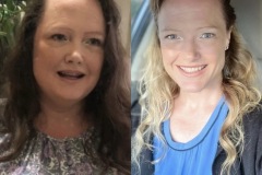 Bariatric Surgery - Before & After Weight Loss Surgery Photo - Gastric Band Sleeve Bypass Balloon