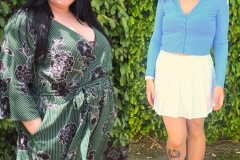 Bariatric Surgery - Before & After Weight Loss Surgery Photo - Gastric Band Sleeve Bypass Balloon