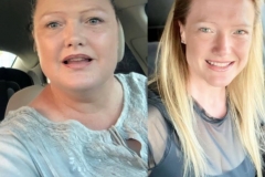 Bariatric Surgery - Before & After Weight Loss Surgery Photo - Gastric Band Sleeve Bypass Balloon