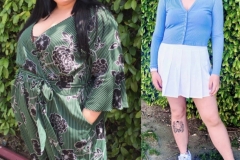 Bariatric Surgery - Before & After Weight Loss Surgery Photo - Gastric Band Sleeve Bypass Balloon
