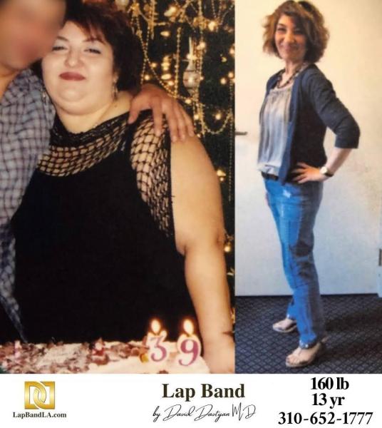 LapBandLA.com