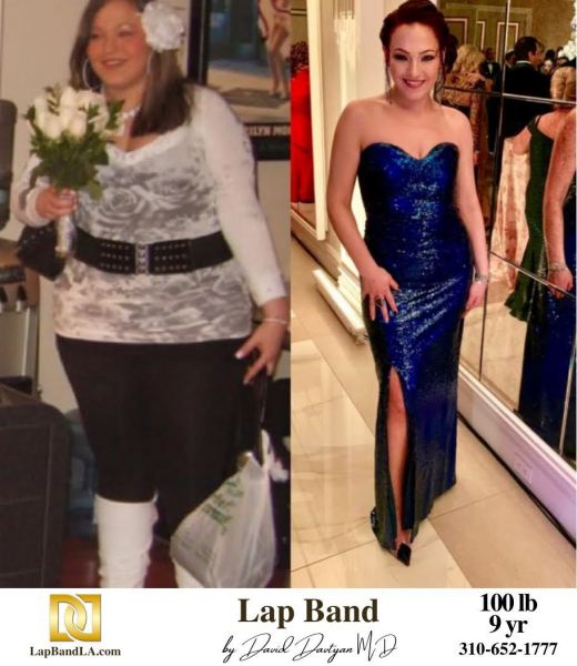 LapBandLA.com