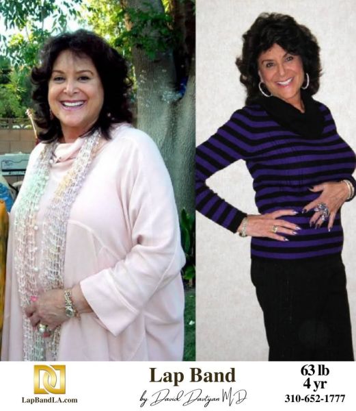 LapBandLA.com