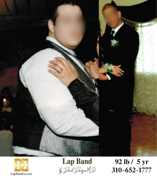 LapBandLa.com