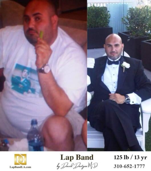 LapBandLA.com