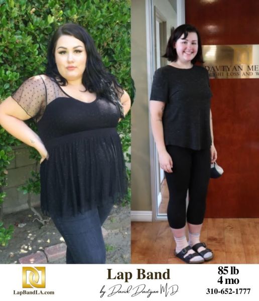 LapBandLA.com