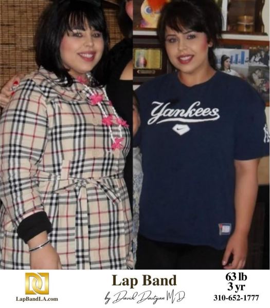 LapBandLA.com