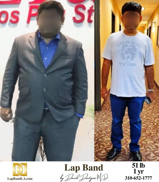 LapBandLA.com