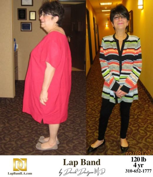 LapBandLA.com