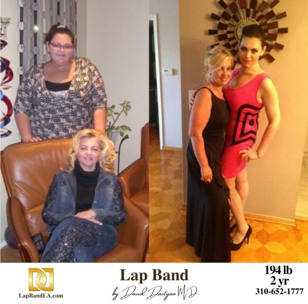 LapBandLA.com