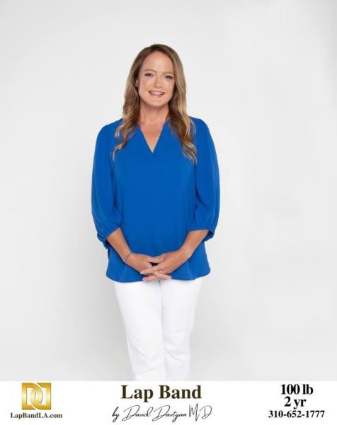 Bariatric Surgery - Before & After Weight Loss Surgery Photo - Gastric Band Sleeve Bypass Balloon
