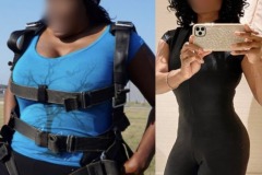 Bariatric Surgery - Before & After Weight Loss - Lap Band