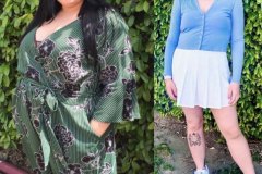 Bariatric Surgery - Before & After Weight Loss - Lap Band