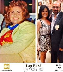 Sonia Cabrera Lap Band Patient with Dr. David Davtyan