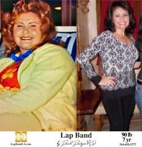 Sonia Cabrera bariatric surgery Patient Before and After comparison