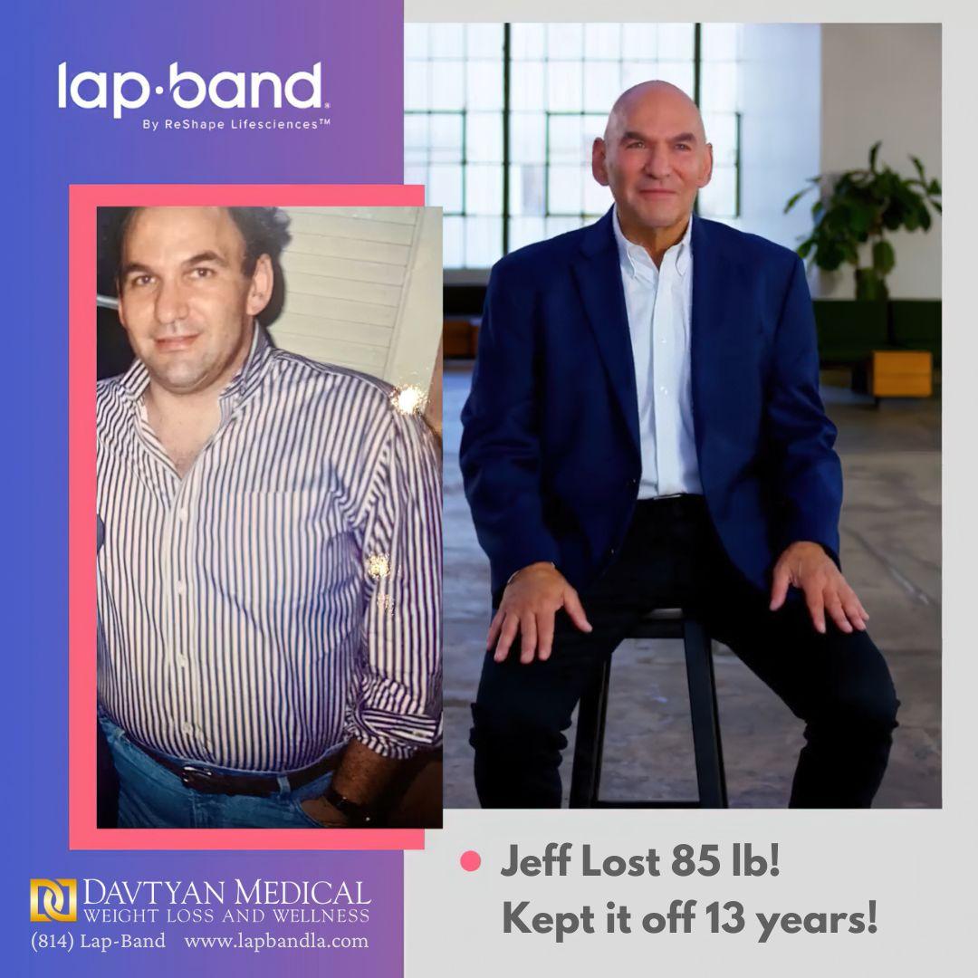 Jeff Weiss Lap-Band Surgery Before and after comparison