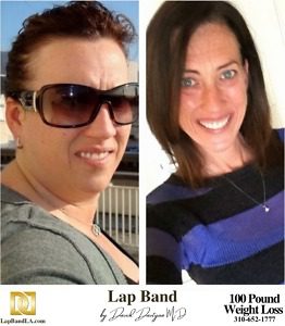 Banded Wendy LapBand surgery Patient Before and After comparison