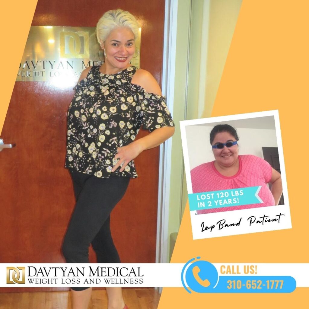 Zoe before and after bariatric surgery with Weight Loss Surgery Center of Los Angeles