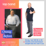 weight loss surgery beverly hills