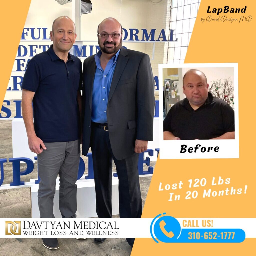 weight loss surgery before and after