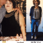 Selina B. Bariatric Surgery before and after los angeles