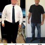 Michael G. Bariatric Surgery before and after los angeles