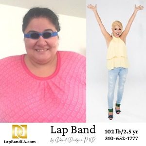 Lap Band benefits Before and After