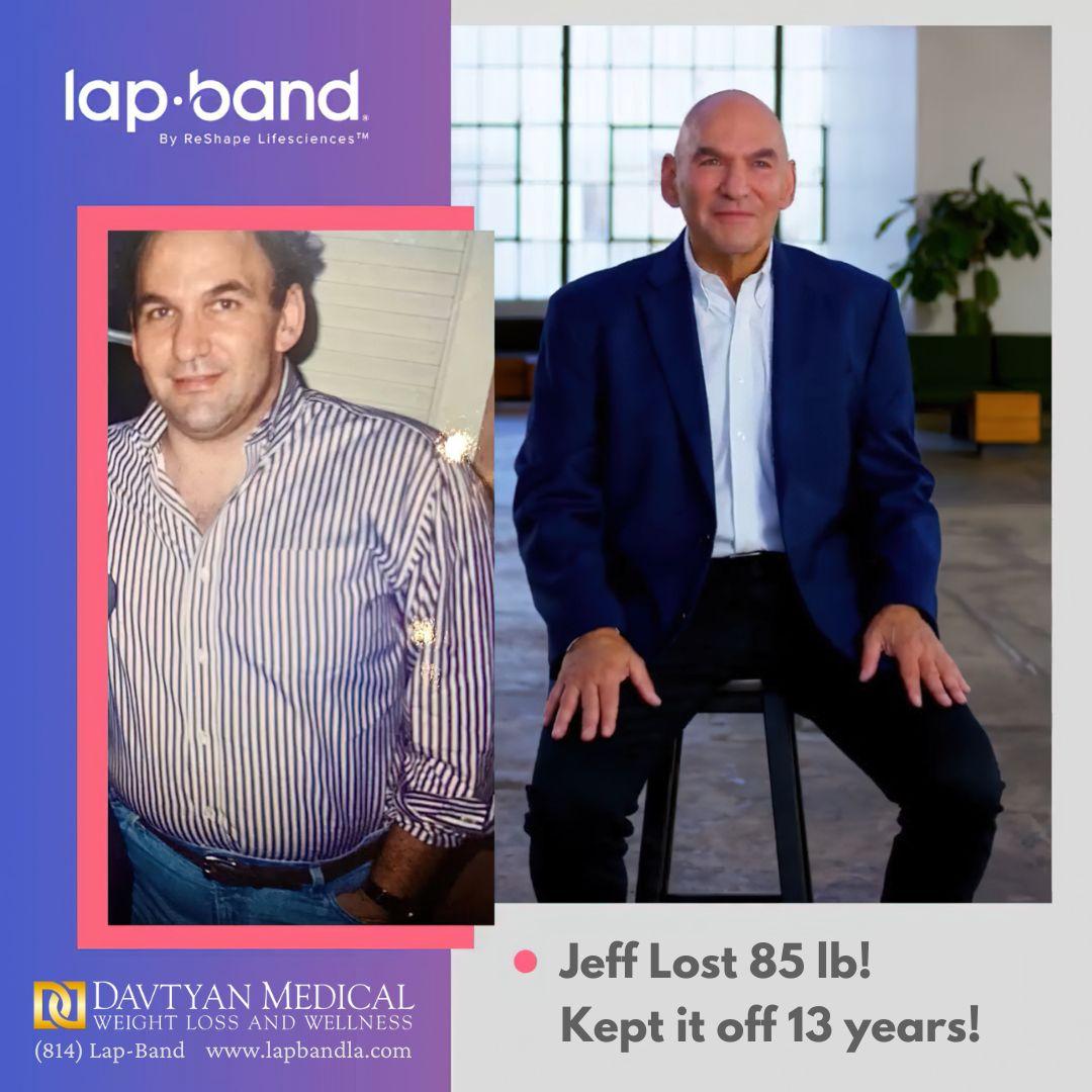 85 lb Weight Loss Maintained 13 Years After Lap-Band Surgery in Los Angeles Patient before and after Lap-Band surgery with 85 lb weight loss maintained over 13 years