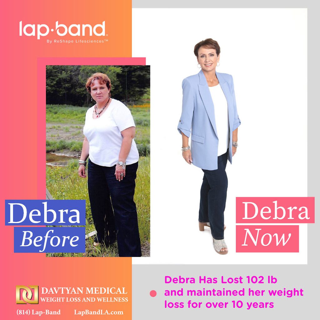 lapband surgery glendale