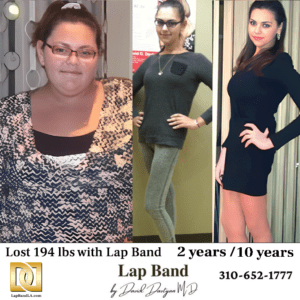 Dr. Davtyan patient lost almost 200 lbs and kept the weight off