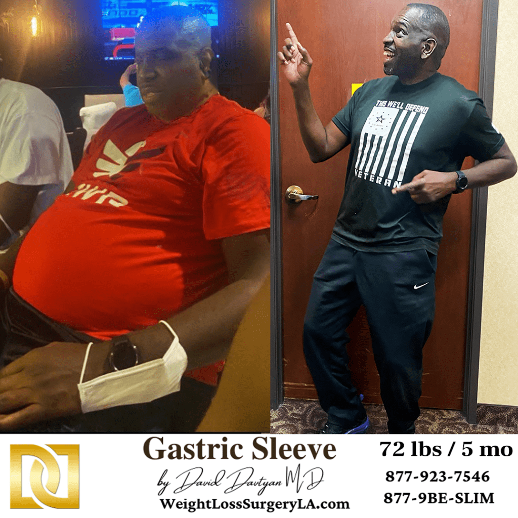 weight loss surgery beverly hills