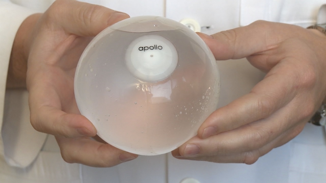 Davtyan Medical Weight Loss and Wellness gastric balloon