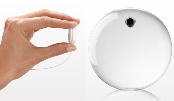 Gastric Balloon Obalon