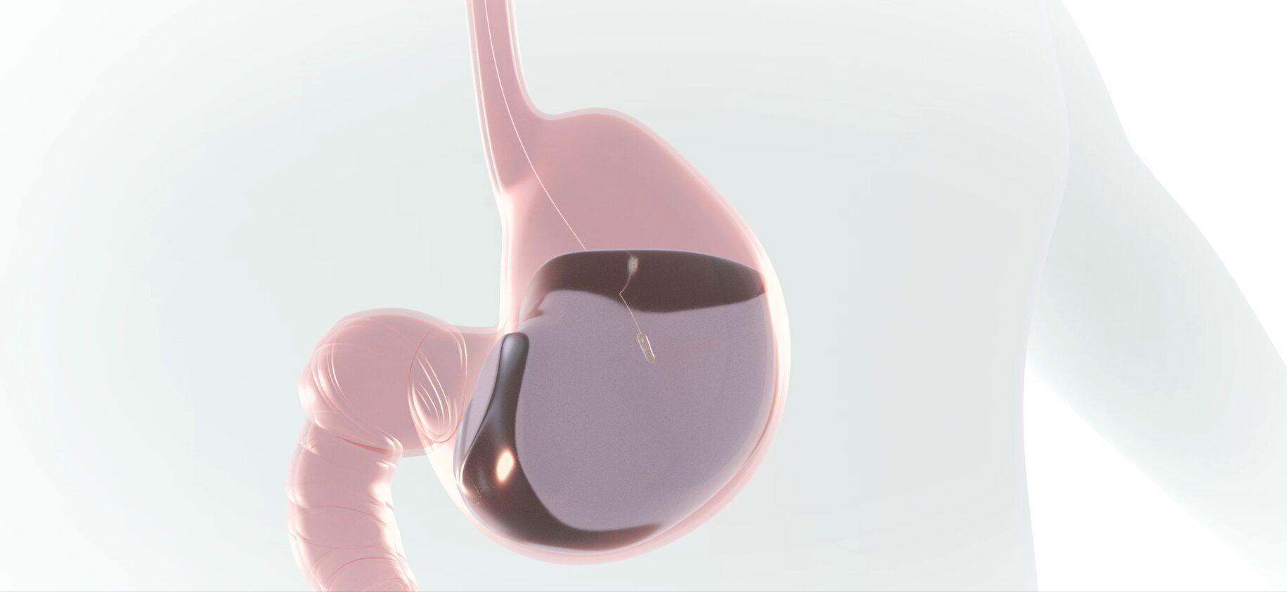 Capsule in stomach Capsule in stomach